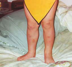 Nouvelles perspectives